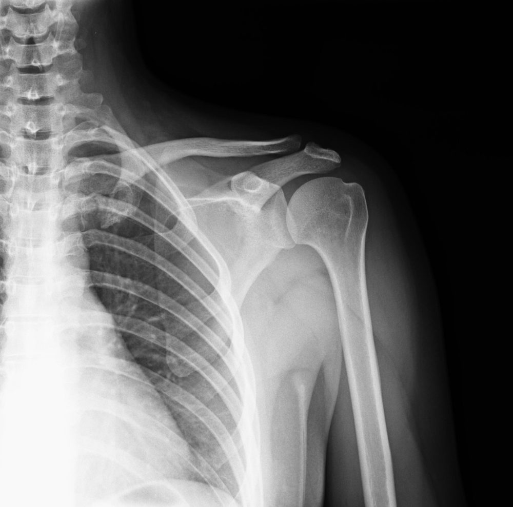 Orthopaedics